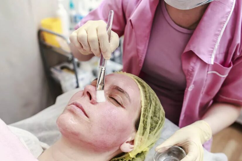 Peelings chimiques et microdermabrasion