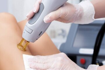 Epilation définitive Pourquoi mon épilation laser est inefficace ?